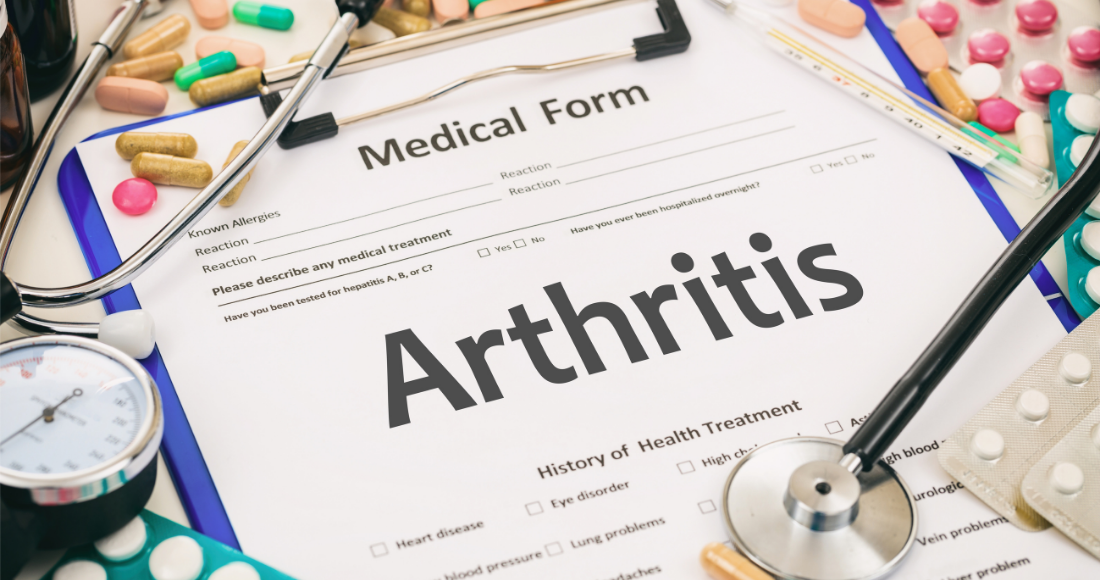 improve your arthritis naturally