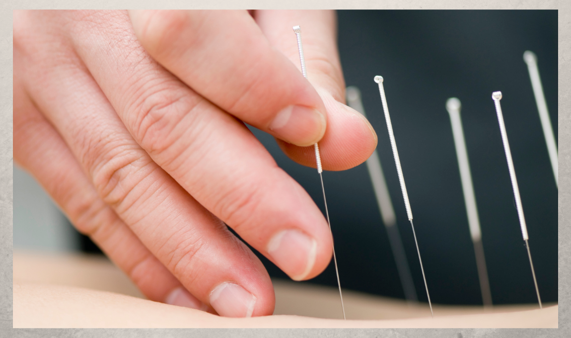 accupuncture for your gut health